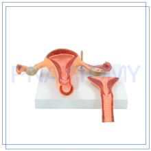 PNT-0586 Uterusmodell für Anatomie Studie Odm